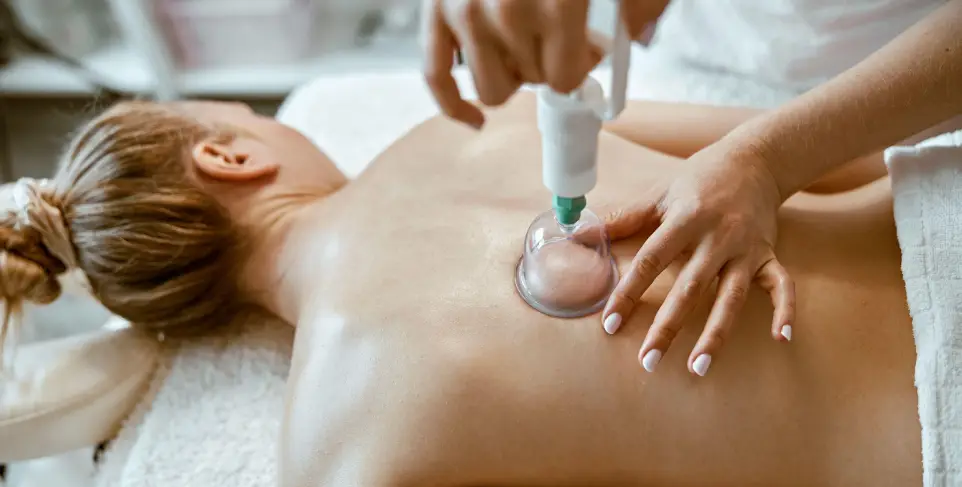 Ventosas (부항, buhang), medicina tradicional en corea del sur